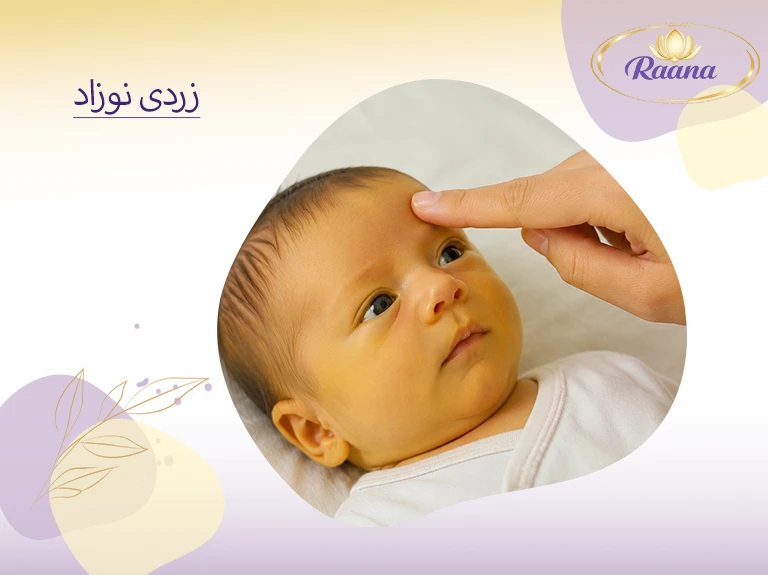 زردی نوزاد؛ چطور زود تشخیص بدهیم